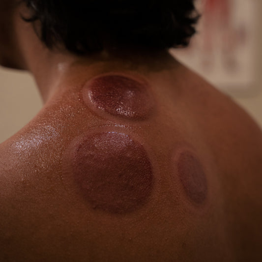 cupping marks on athletes