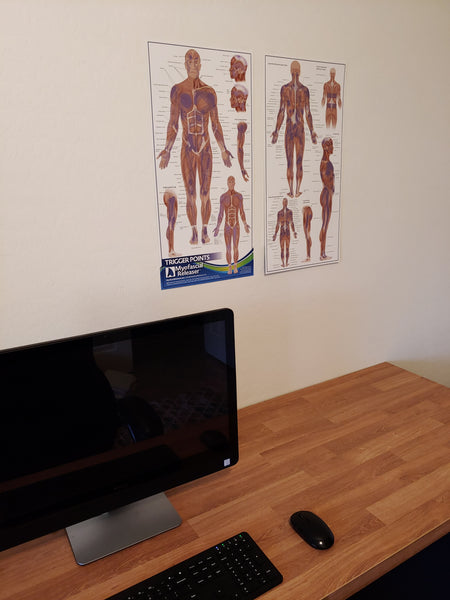 Trigger Point Anatomy Map (Poster sized) Pack of 2