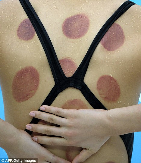 Professional Cupping Therapy Set