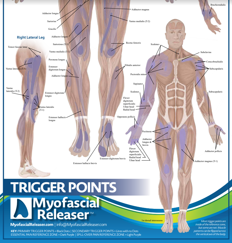 Two Trigger Point Anatomy Maps Medical Office Wall Poster For Refere two-trigger-point-anatomy-maps-medical-office-wall-poster-for-refere