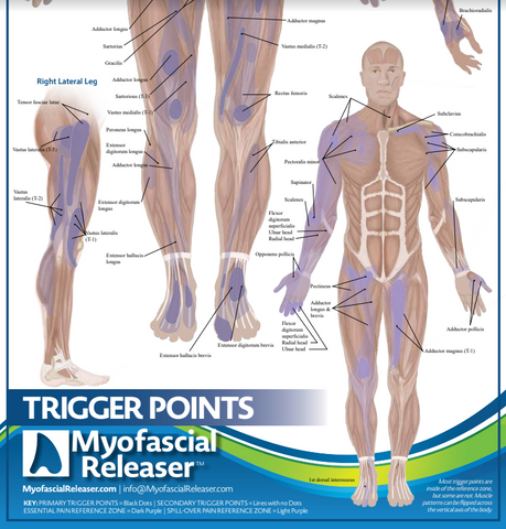 Trigger Point Anatomy Map (Poster sized) Pack of 2